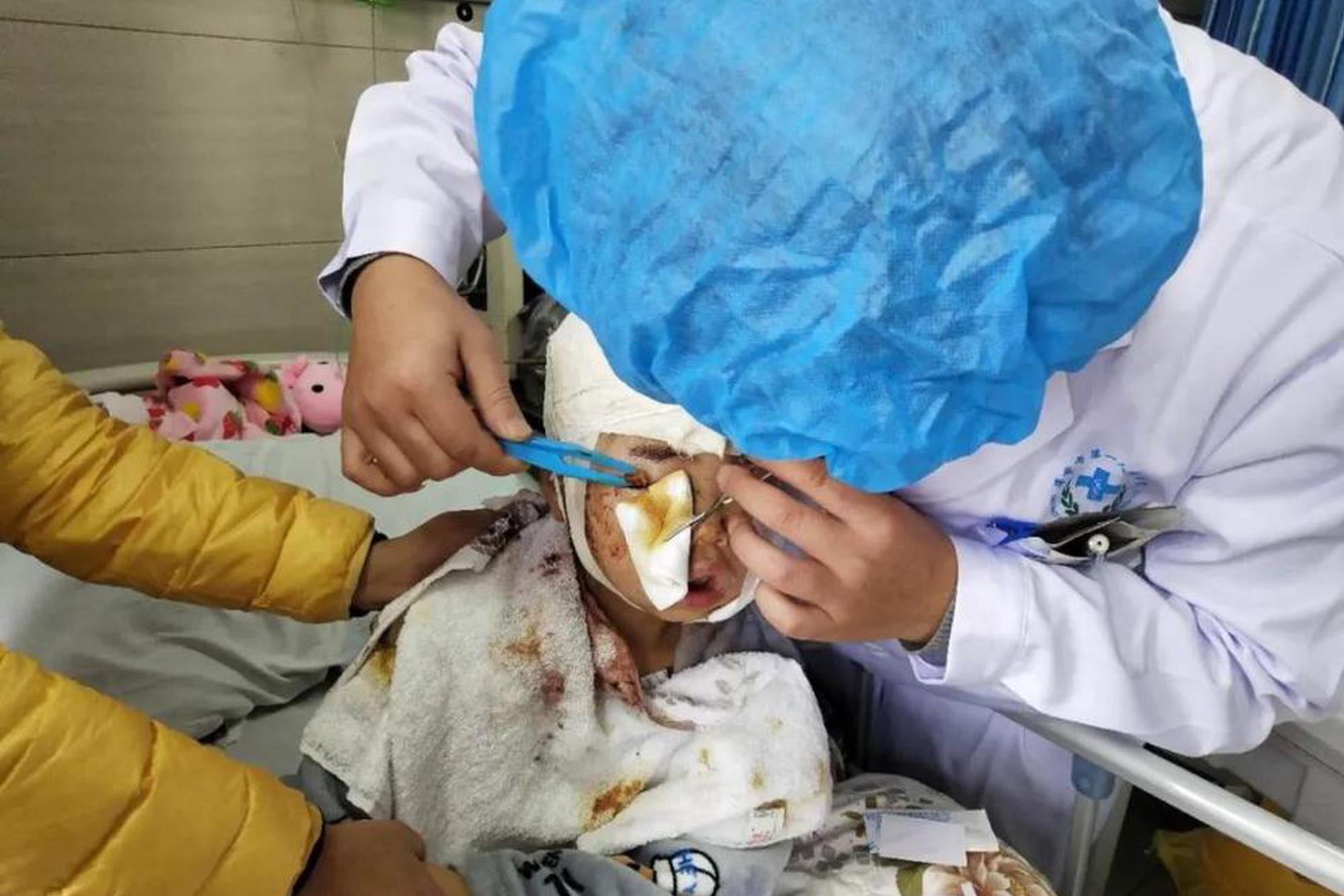 开拓者正义之怒变龙之后攻击需要注意什么